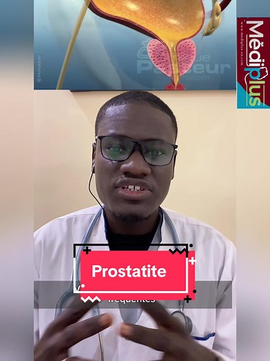 Prostatite : Comprendre et Prévenir les Risques