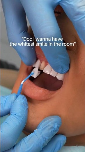White #teeth are great, but are they also durable? 🦷