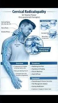 Understanding Cervical Radiculopathy: When neck compression radiates down your arm
