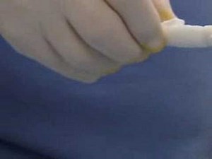 Man has Microchip Implanted