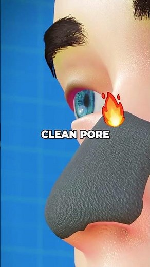 How To Get Rid Of Blackheads Fast!