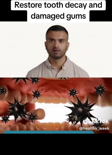 Restore tooth decay and damaged gums while you sleep at nights. click the link in my bio for full details #teeth #dentist #smile #dental #dentistry #teethwhitening #tooth #dentalcare #oralhealth #dentista #cosmeticdentistry #orthodontics #dentalclinic #braces #dentalimplants #dentalhygiene #veneers #smilemakeover #invisalign #dentalhygienist #whiteteeth #odontologia #health #dentalphotography #dentalhealth #beauty #dentistryworld #dentalassistant #teethcleaning #oralcare