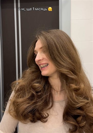 #брекети #зуби #braces #teeth #fyp