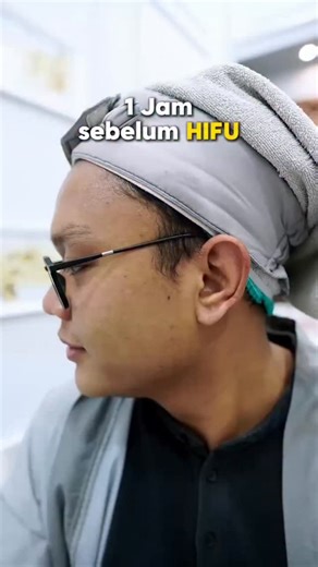 Di umur berapa kamu baru tahu kalau bikin pipi tirus itu nggak harus mahal? Nih mimin kasih tahu rahasianya treatment paling worth it buat bikin wajah kelihatan lebih tirus dan kencang! Namanya HIFU, cukup 1x treatment aja hasilnya udah kelihatan. Cocok banget buat kamu yang pengin punya wajah v-shape dan pipi tirus tanpa ribet #HIFU #SemuaBisaBening #PipiChubby | gopos.id