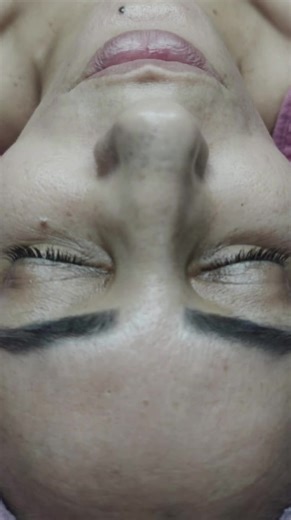 Parce que la beauté la plus élégante reste la plus naturelle. Des technologies anti-âge de pointe pour lisser les rides, raffermir la peau et révéler un visage lumineux… sans injections. Votre peau mérite l’excellence #rides #antiage #institutdebeauté #esthéticienne #botox