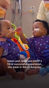 Meet Amari and Javar Ruffin, the 32nd pair of conjoined twins successfully separated by our team! Amari and Javar were diagnosed prenatally in The Center for Fetal Diagnosis and Treatment at CHOP and spent 10 months in our hospital preparing for separation. On August 21, 2024, a team of two dozen specialists, including surgeons, anesthesiologists, radiologists, nurses and many others, operated for eight hours to separate the boys. Now, Amari and Javar are officially home! Read their story here: