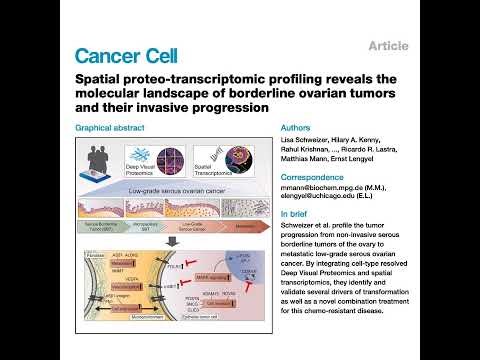 085-Spatial landscape of borderline ovarian tumors