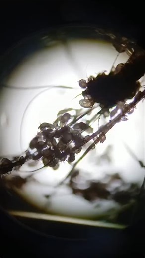 Bad case if mange from one of our residents who, after treatment has no live mites anymore. This was just a tiny skin sample magnified under the microscope 😍🦔💜 | Hope for Hedgehogs Woodside