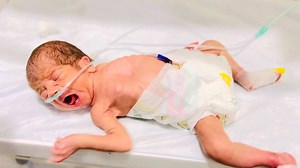 Cute Kitten Baby of Rahman ❤️ _ Daily Care & Health Update RBS Check Improving Health Care #baby #babycare #newborn #viralshorts Welcome to this heart-touching journey of Rahman’s newborn baby kitten 🐾. In this video, we share the daily routine check-up, feeding moments, and health care of this tiny fur baby. Watch how the kitten grows stronger each day with love, care, and proper attention. 💕 From feeding, cleaning, playing, and health monitoring, every moment is filled with cuteness and joy.