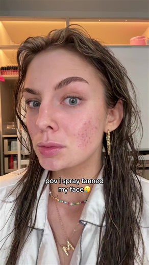 bruhhhh my skin was JUST clearing #acne #spraytan | spray tan