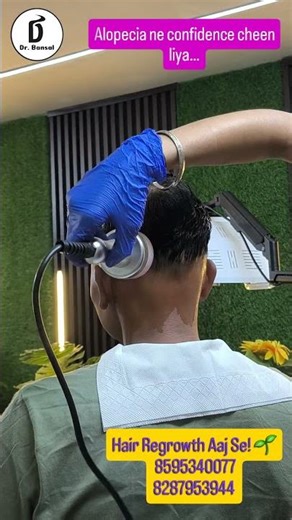 Alopecia Areata Explained: Causes, Symptoms, and Effective Treatments with Dr. Bansal