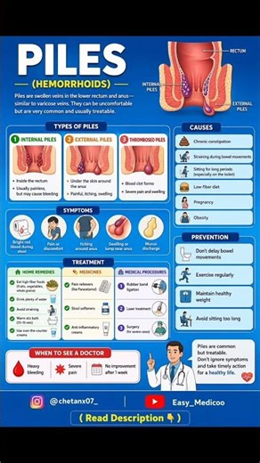 Piles🚽🩸#piles #hemorrhoids #pilestreatment #pilescare #medicaleducation #medico #facts #pharmacology