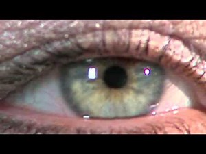 The Evolution of the Eye