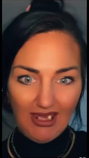 She got FREE NHS "plastic" teeth