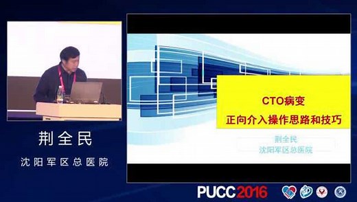 PUCC课程｜荆全民：CTO病变正向介入操作思路和技巧