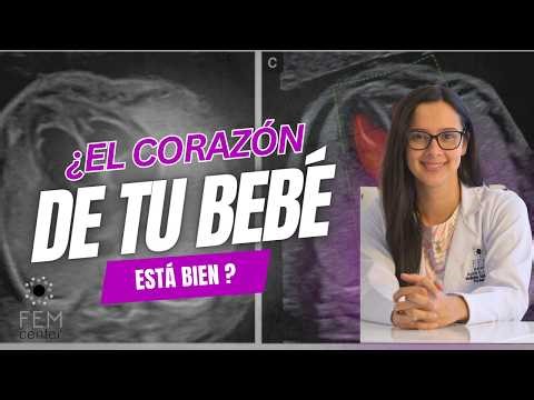 Problemas en el corazón del bebé ( Cardiopatias congénitas)