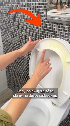 How to remove yellow stains from a toilet seat?