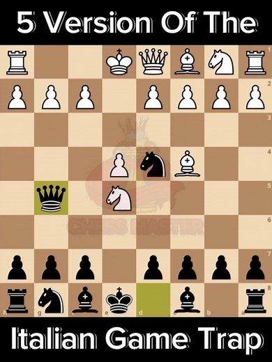 Watch the full video 👇👇👇 | Chess Master