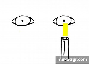 Relative Afferent Pupillary Defect/Marcus Gunn Pupil on Make a GIF