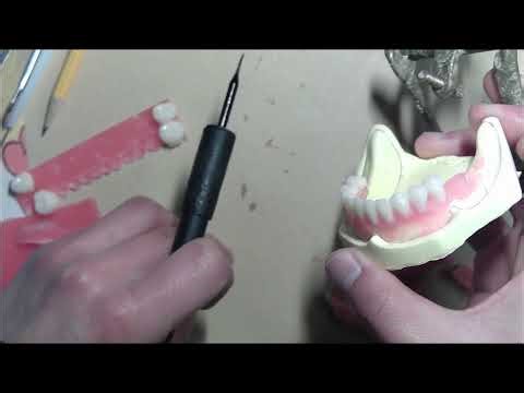 Complete denture arrangement