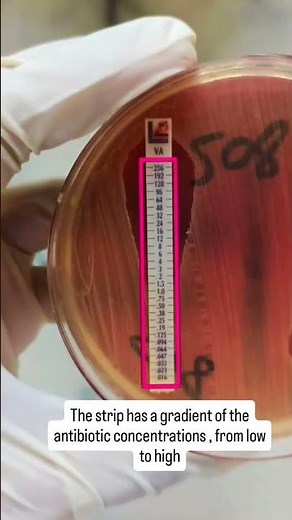 E test in Antibiotic Susceptibility Testing for MRSA in Microbiology lab #antibioticsensitivity