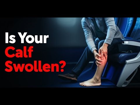 Deep Vein Thrombosis (DVT): The Swollen, Painful Calf After a Long Flight