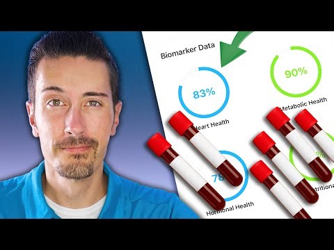 Before You Buy Siphox Health Test - What You Should Know