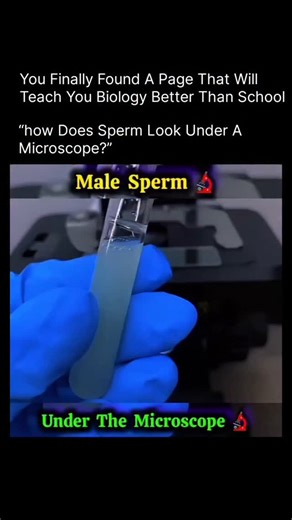 Anatomy | Physiology | Body facts | How Does Sperm Look Under a Microscope? 🔬🧬 Under a microscope, sperm cells look like tiny tadpoles. Each sperm has three main parts: Head... | Instagram