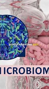 What Is Bloating Actually? (And How to Fix It)