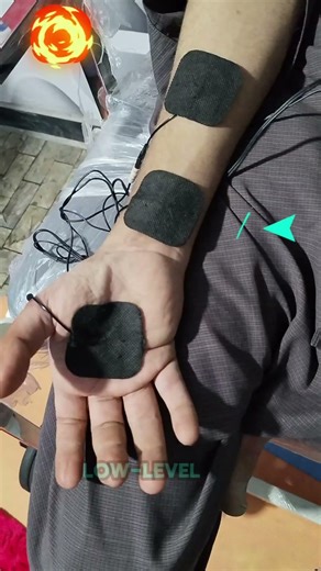 Frozen Phalanges (Finger Bones) Stimulation After Surgery #physiotherapist #physiotherapy