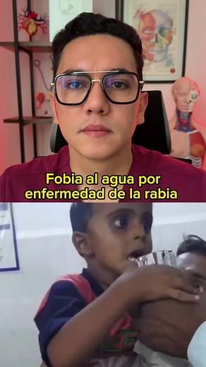 Dr. William Guerrero | Fobia al agua por enfermedad de la rabia (Hidrofobia)