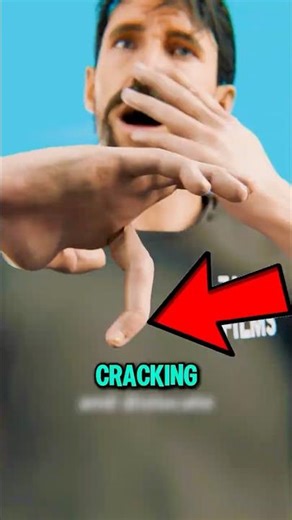 What Could Happen If You Keep Cracking Your Knuckles?!