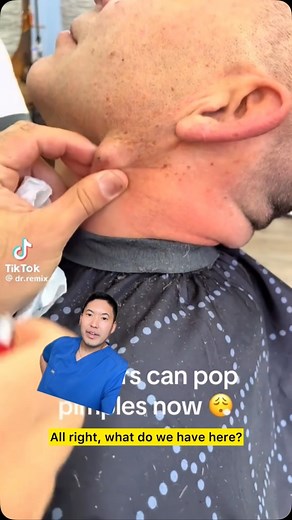 Dr. Daniel Sugai, MD, FAAD on Instagram: "Don’t do this! Going after an epidermoid cyst like this can create new problems including a ruptured inflamed cyst or even an infection! 😱I have seen this way too many times. 😢 #dontdoit #pimplepop #cystpopping #pimplepopper #cystextraction #drsugaiskincare #barbertok #duet @ Dr. Remix"