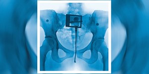 封面大公開！Lorde 全新專輯《Virgin》即將登場