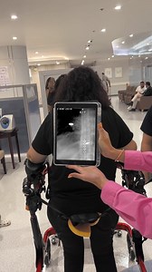We get so many questions about our Epidural Stimulators, so we want to give you a closer look at what this incredible medical technology looks and feels like. This is Mevljude, who has arrived from Switzerland to our Bangkok 🇹🇭 hospital. Her C6 complete spinal cord injury is being treated with an Epidural Stimulator, which you can see in the x-ray. Commonly asked questions about Epidural Stimulators: 💬 How soon do you notice changes? Most patients notice muscle activation as soon as the stimu