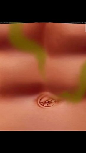 ASMR Beauty on Instagram: "ASMR Navel Stone Removal Treatment | ASMR Beauty #asmrbeauty #viralreels #asmr #asmrvideo #reels #instareels #instagramreels #reelsoftheday #reelsinstagram #satisfyingvideos #viral #viralvideos #trending #treatment #transformation #tiktokviral #trendingreels #skincareroutine #spa #skincare #satisfyingasmr #belly #beauty #explore #animation #acnetreatment #asmrcommunity #asmrsounds #asmrtriggers #asmrbeautytips"