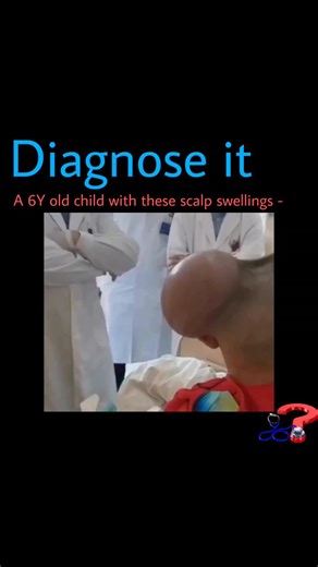 Dr Harsh Duhan on Instagram: "🩺 Test Your Diagnostic Skills! 🔍 Think you can crack today’s case? Drop your guess below ⬇️ 💬 Comment "Details" to get the complete answer delivered straight to your inbox! 📚 Want 178+ real clinical cases with explanations? Grab our Case Series eBook—perfect for NEET PG, INICET, USMLE & more! DM @diagnose_it to get yours. 🚨 Giveaway Alert! Share this post in your stories + tag us for a chance to WIN a free Case Series eBook! 🎉 👥 Tag your smartest friend and s