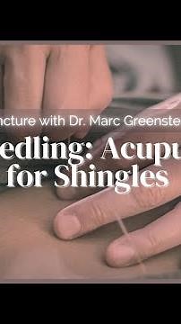 Fire Needling: Acupuncture for Shingles