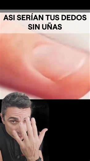 This Is What Your Fingers Would Look Like Without Nails.#survival #didyouknow #curiosities
