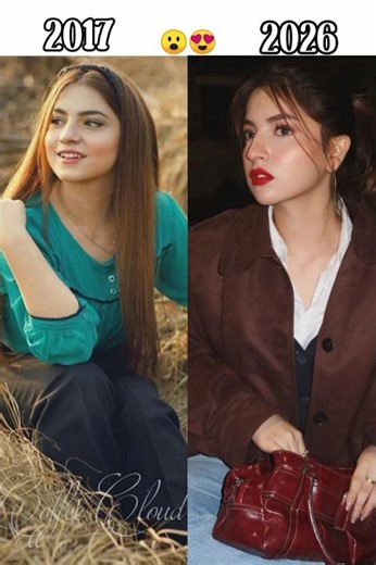 Pak actress 2017 VS 2026 look❤❤❤❤❤❤❤❤❤❤❤