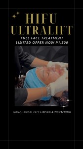 ✨ Face Lift Without Surgery? YES, It’s Real — 𝗛𝗶𝗳𝘂 𝗨𝗹𝘁𝗿𝗮𝗹𝗶𝗳𝘁 𝗙𝘂𝗹𝗹 𝗙𝗮𝗰𝗲 𝗧𝗿𝗲𝗮𝘁𝗺𝗲𝗻𝘁 NOW P1,500 Not just another facial — this is a precision-targeted, non-surgical lift using advanced HIFU technology to contour, tighten, and rejuvenate from deep within. ✅ Lift & define your jawline ✅ Smooth out fine lines ✅ Boost collagen from deep within ✅ Look years younger — instantly 📍 ICONIQUE Skin – Mall of Asia | Greenhills | Makati 🕒 Limited slots available. Non-invasive. No 