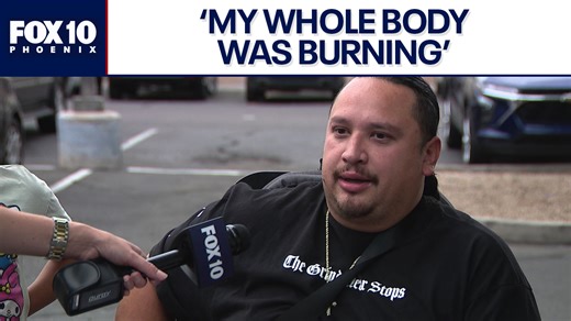 'Whole body was burning': Tempe bee attack victim recounts terrifying ordeal