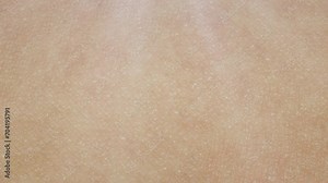 3D Animation Cream Drop Skin Acne Repair Effect Stock Video