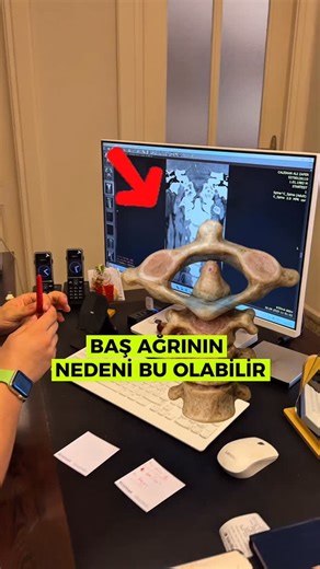Fzt. Dr. Reşat Coşkun on Instagram: "Atlas-Axis Method"