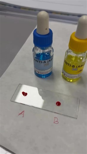 Understanding Blood Groups in the Laboratory