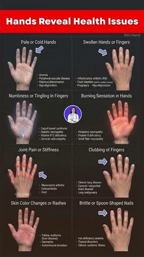 What Your Hands May Be Telling You About Your Health ✋🏻
