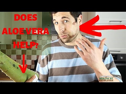HOW TO USE ALOE VERA TO HEAL WOUNDS