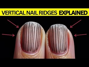 Stop Ignoring Vertical Nail Ridges! Here's What to Do