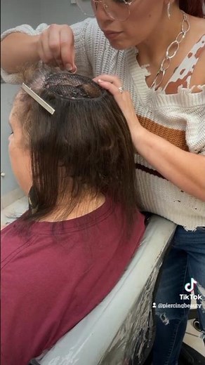 Mesh Integration Hair System Install for thinning hair and scalp coverage