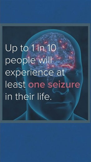 Seizures - A Basic Explainer